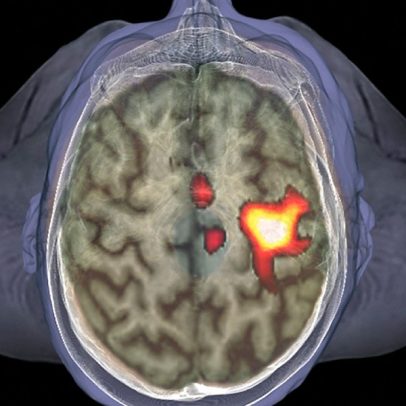 Cérebro ativa células imunológicas ao detectar pessoas doentes por perto