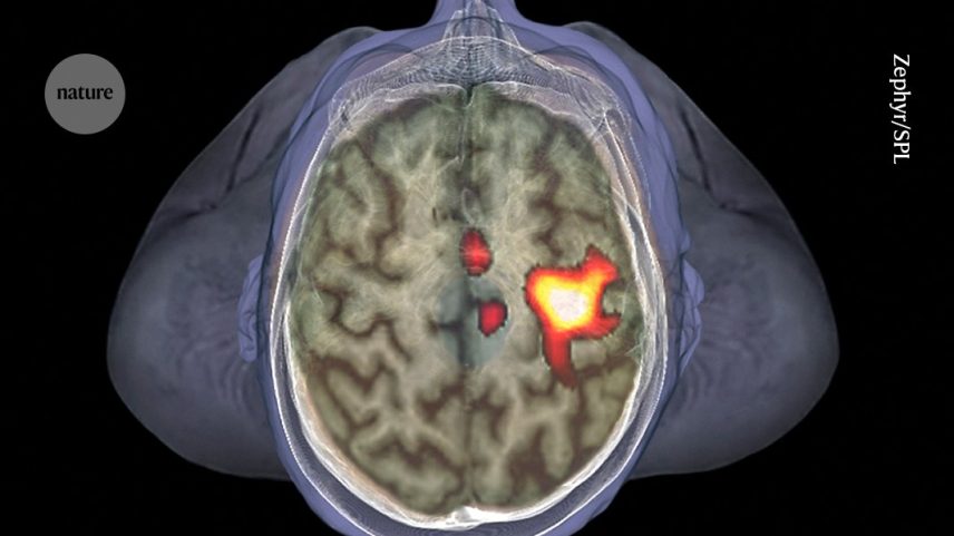 Áreas do cérebro que ajudam a monitorar o espaço próximo a uma pessoa ativam células imunológicas quando a infecção ameaça. (Foto: Zephyr/Science Photo Library)