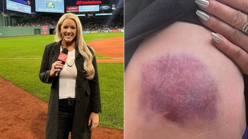 Repórter Audra Martin (Foto: Reprodução/Instagram)