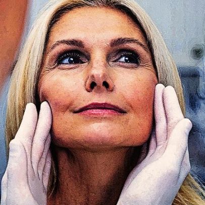 Técnicas inovadoras rejuvenescem sem alterar a expressão facial das pessoas