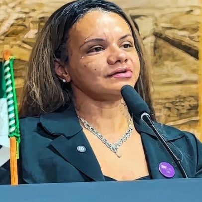 Mulher que levou 61 socos recebe medalha e exibe rosto após um mês de recuperação