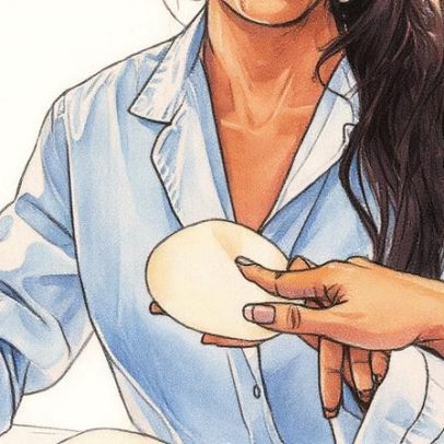 Cirurgia de prótese mamária se moderniza para atender mulheres ativas