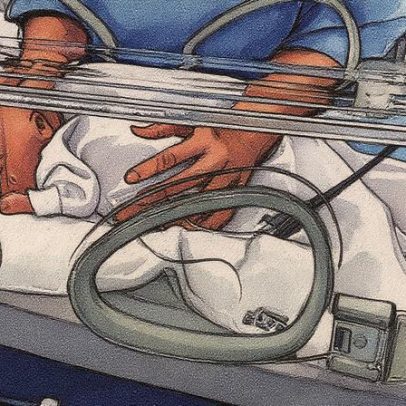 Dois bebês prematuros falecem após contaminação por detergente em hospital italiano