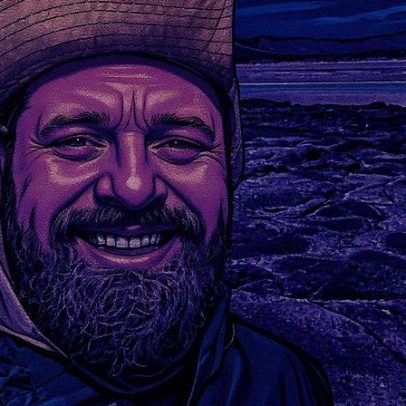 Osteonecrose no fêmur pode ser causada por corticoides e exigir prótese no quadril