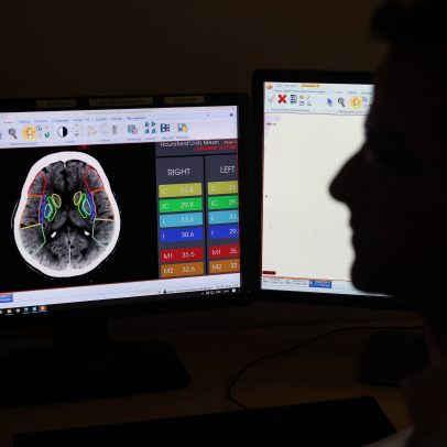 Inteligência artificial promete diminuir desigualdades sociais e econômicas