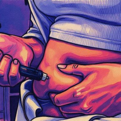 Nova injeção para obesidade promove emagrecimento sem alterar hábitos alimentares