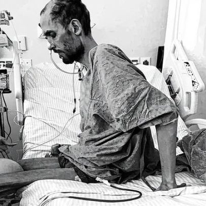 Paciente aguarda transplante de cinco órgãos do mesmo doador após longa espera