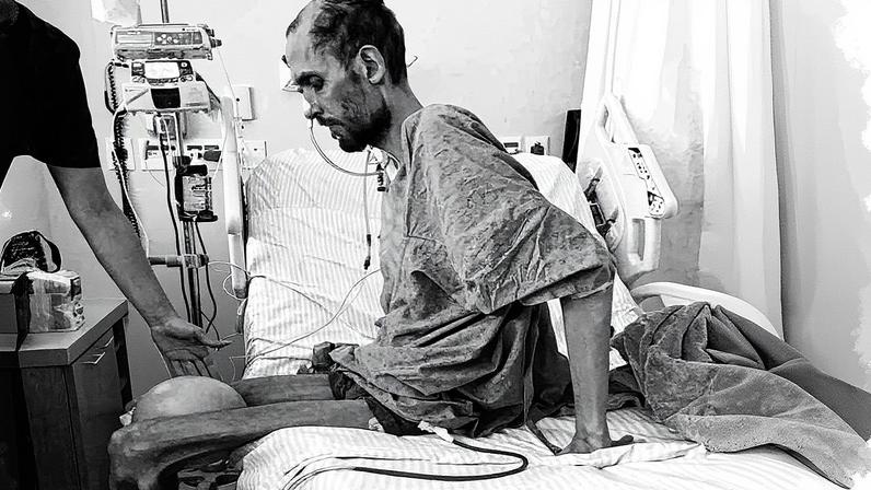 Homem que recebeu transplante de cinco órgãos pesa 34 kg (Foto: Reprodução)