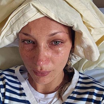 Bella Hadid compartilha fotos preocupantes do hospital enquanto irmã a apoia