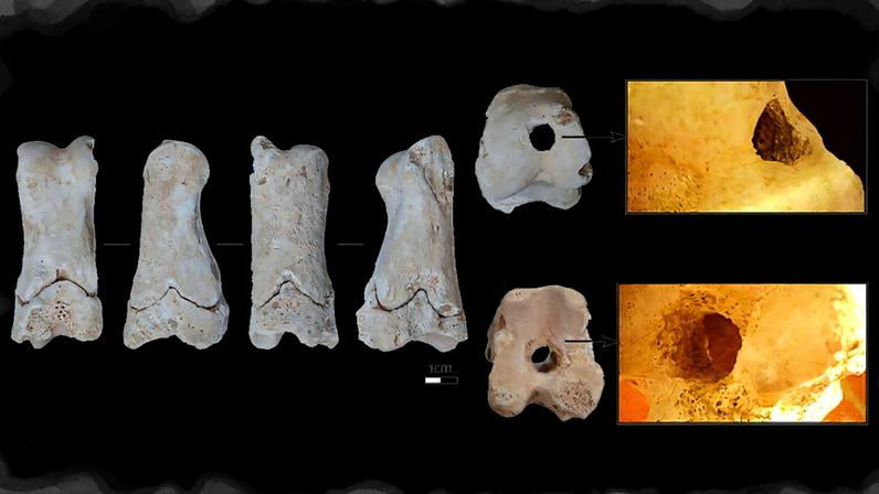 (International Journal of Osteoarchaeology (2025)./Reprodução)