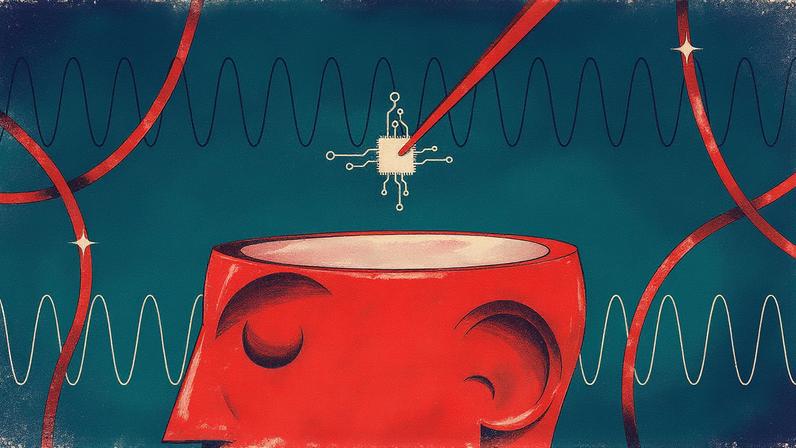 Startup chinesa desenvolve chip cerebral (Foto: Reprodução)