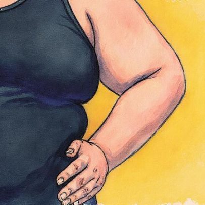 Excesso de peso aumenta risco de câncer de intestino, alerta especialista