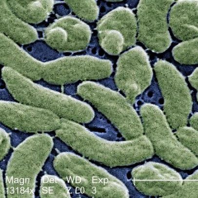 Bactéria comedora de carne causa morte de quinta vítima nos Estados Unidos