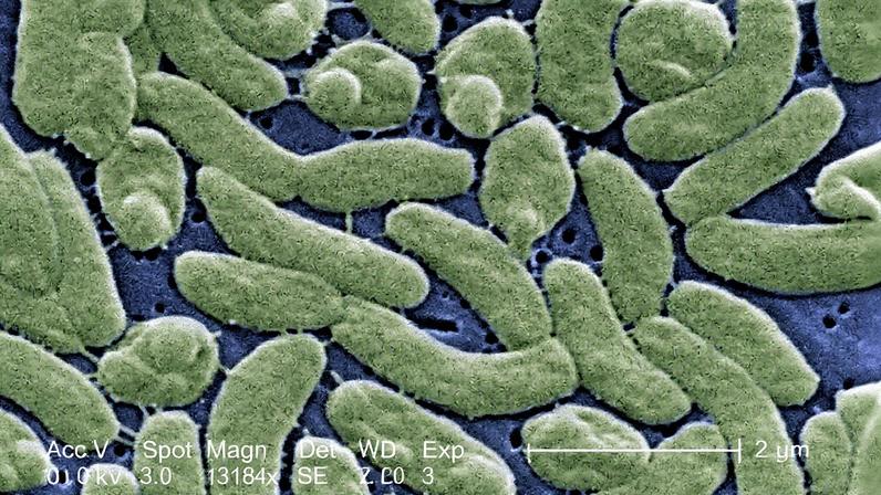 Bactérias Vibrio vulnificus em imagem microscópica (Foto: Reprodução)