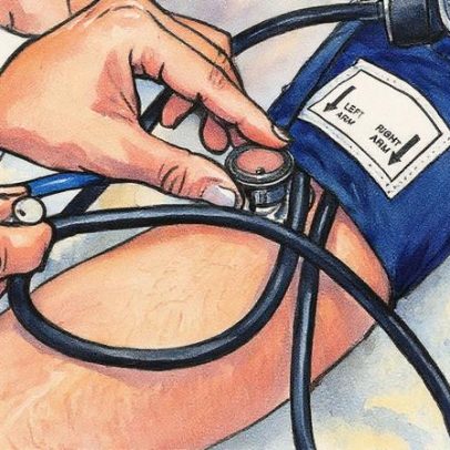 Nova diretriz de hipertensão altera cuidados para quem tem 12 por 8