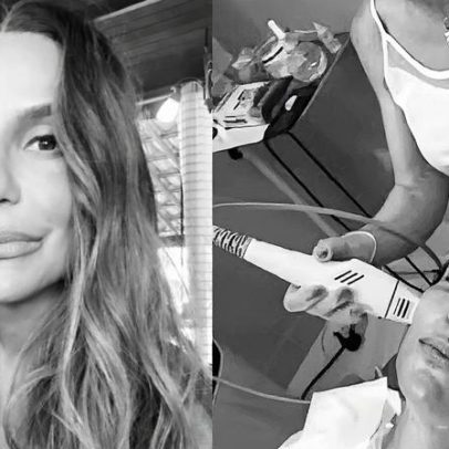 Ivete Sangalo adota técnica coreana Coolfase para combater flacidez na pele