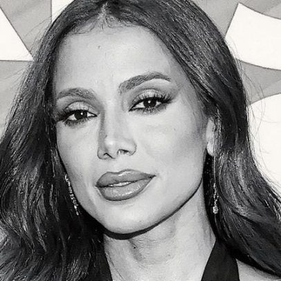Anitta defende sua decisão de falar sobre mudanças na aparência e afirma: 'É da minha conta'