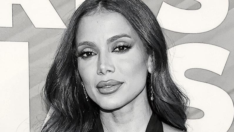 Anitta discute novos procedimentos estéticos e mudanças em seu rosto (Foto: Reprodução)