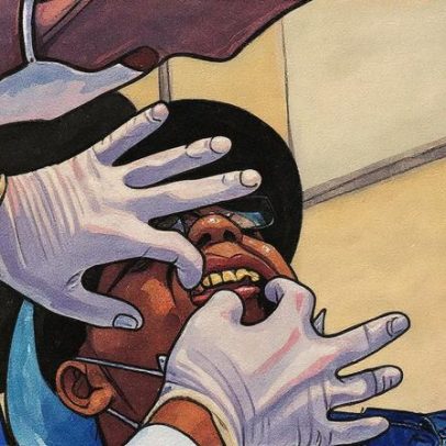 Bactérias e fungos bucais aumentam risco de câncer de pâncreas em até três vezes