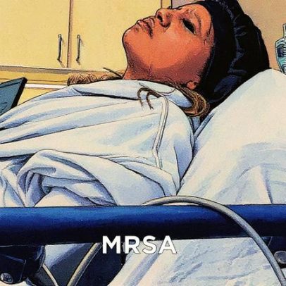 Superbactérias resistentes podem causar mais mortes que o câncer no futuro