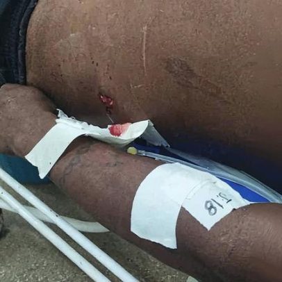 Funai alerta sobre riscos de conflitos após morte em rodovia envolvendo indígenas