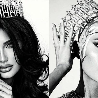 Miss dos EUA exibe alopecia e desafia padrões de beleza em ensaio impactante