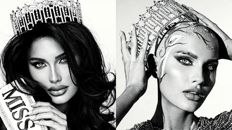 Miss dos EUA, Mary Sickler, aparece careca e fala sobre alopecia (Foto: Reprodução)