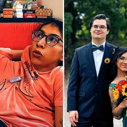 Gêmea siamesa compartilha experiência de viver com o casamento da irmã