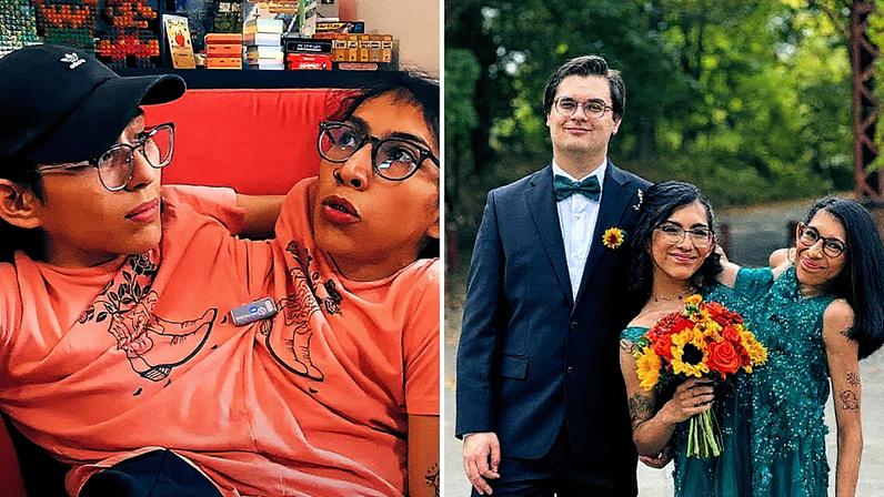 Carmen Andrade, gêmea siamesa, se casa (Foto: Reprodução)