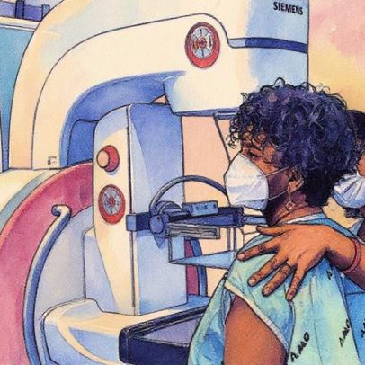 Busca por mamografia e papanicolau diminui, enquanto colonoscopia ganha destaque