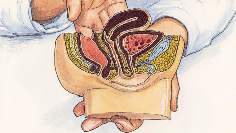 Cerca de 5% a 10% dos casos têm origem hereditária clara, enquanto 90% são esporádicos, relacionados a fatores ambientais e estilo de vida (Foto: Reprodução)