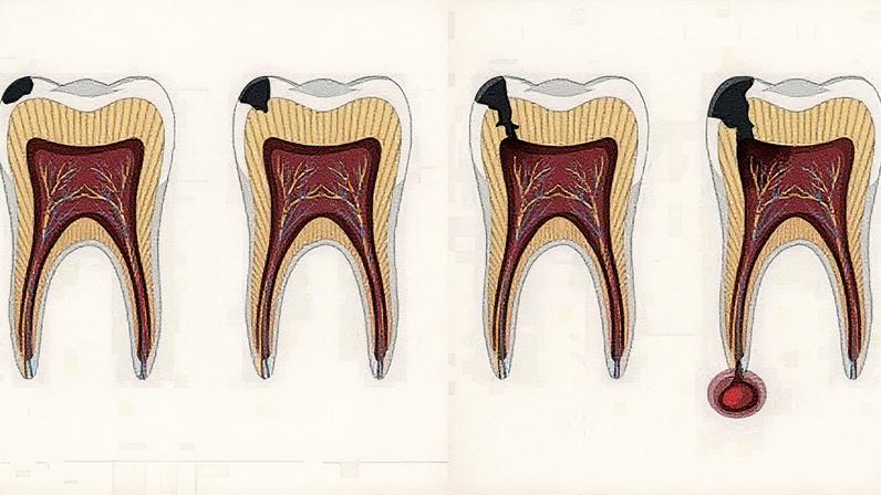 Pesquisador da Unesp discute a necessidade de estudos clínicos para avaliar efeitos em humanos, destacando benefícios dos exercícios físicos e do consumo de ômega-3 (Foto: Reprodução)