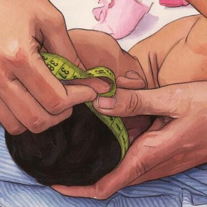 Governo estabelece regras para indenização e pensão a vítimas do vírus Zika