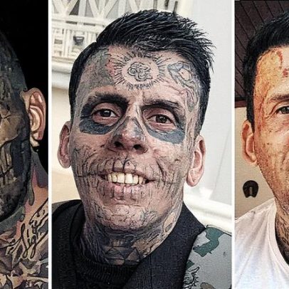 Ex-homem mais tatuado do Brasil exibe progresso na remoção de tatuagens faciais