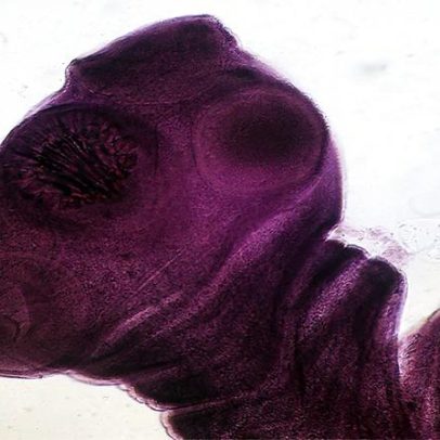 Larva de tênia é identificada como principal causa de epilepsia em países em desenvolvimento