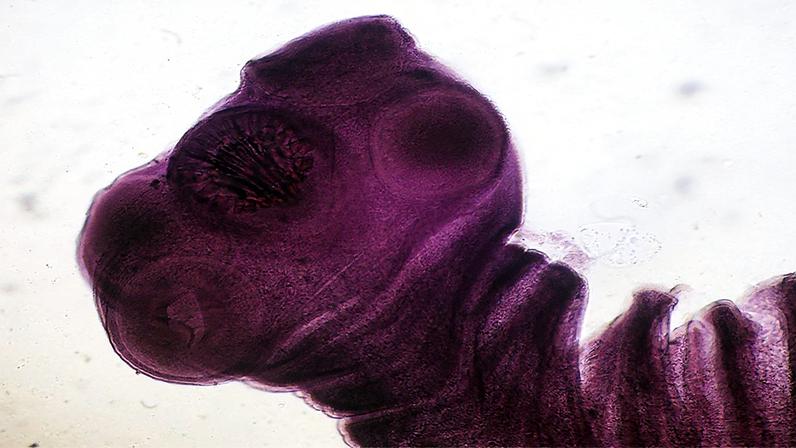 Taenia solium, conhecida como “tênia” ou “solitária” do porco, é o parasita responsável pela neurocisticercose (Foto: Reprodução)