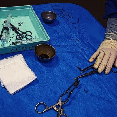 Estudos revelam falhas na esterilização de materiais utilizados em cirurgias