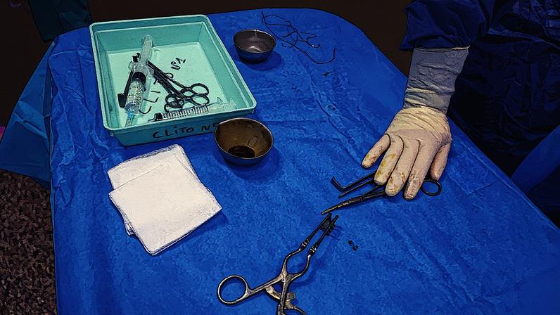 Instrumentos cirúrgicos dispostos sobre uma superfície (Foto: Reprodução)