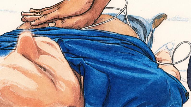 Manobra de ressuscitação cardiopulmonar sendo realizada por uma pessoa (Foto: Reprodução)