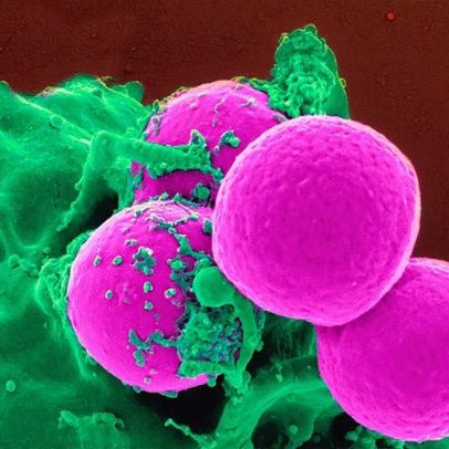 Mini plataforma portátil melhora detecção de bactérias resistentes a antibióticos