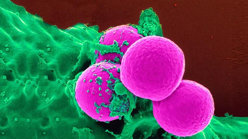 Representação da MRSA (Staphylococcus aureus resistente à meticilina) (Foto: Reprodução)