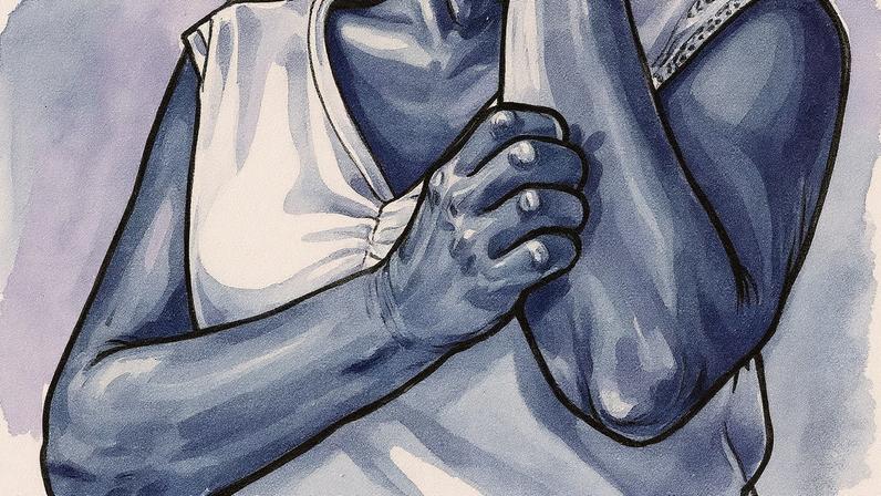 Problema de pele (Foto: Reprodução)