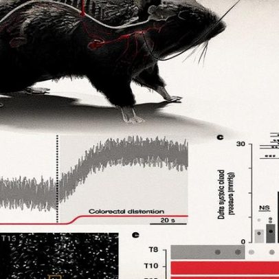 Arquitetura neuronal revela mecanismos da disreflexia autonômica