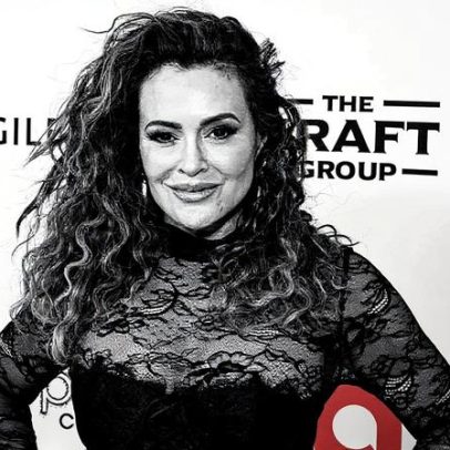 Alyssa Milano anuncia a remoção de seus implantes mamários