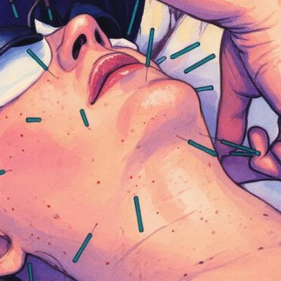 Acupuntura facial se torna tendência como alternativa natural ao botox