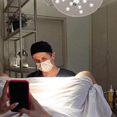 Ninfoplastia sem cortes pode causar queimaduras e complicações, alerta especialista