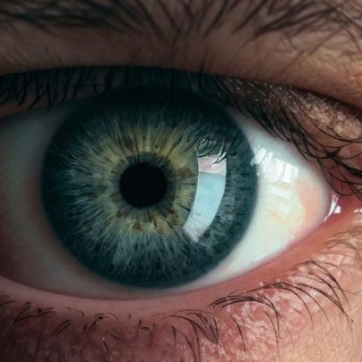 Cores dos olhos: descubra o que as determina e entenda a heterocromia
