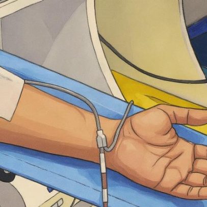 Sociedade de Reumatologia pede mais centros de infusão no SUS