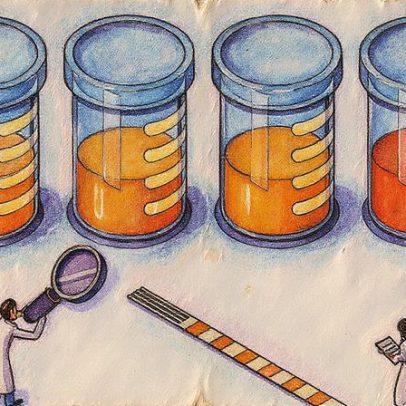 A cor da urina revela informações sobre saúde, dieta e exercícios físicos