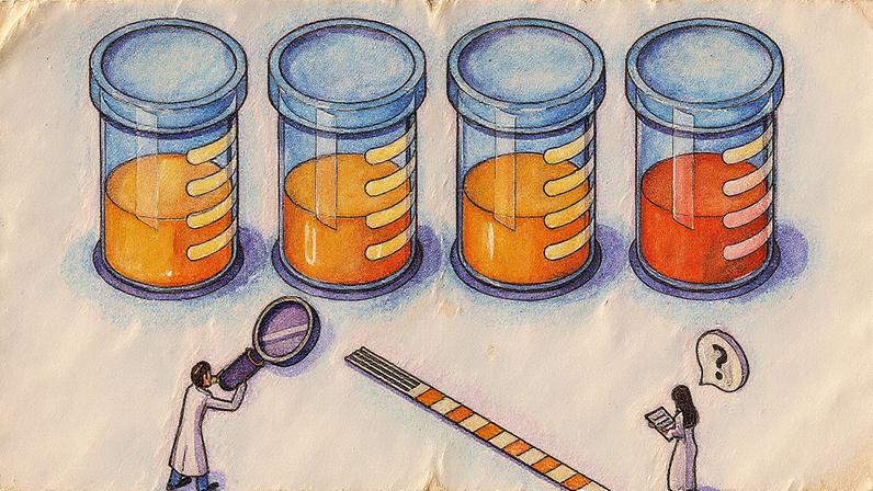 Alterações na cor e odor da urina podem indicar a necessidade de investigação (Foto: Reprodução)